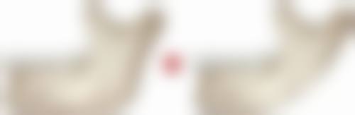 一、为什么打瘦脸针1个月没成效之药物吸收情况