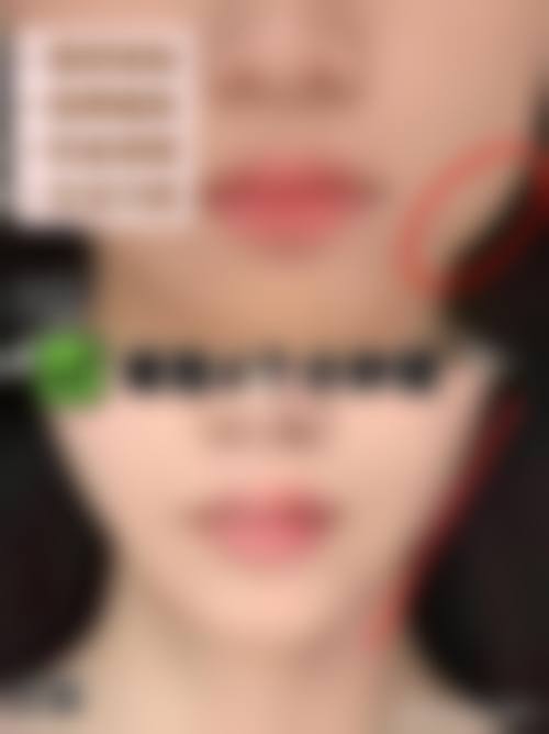 七、邯郸星璨美容整形外科诊所预约方式