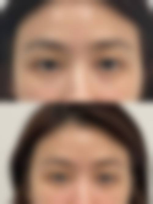 九、天津南开怡丽亚韩整形美容医院真实的患者评价