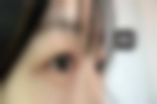 八、成都高新尚美汇医疗美容诊所真实的患者评价