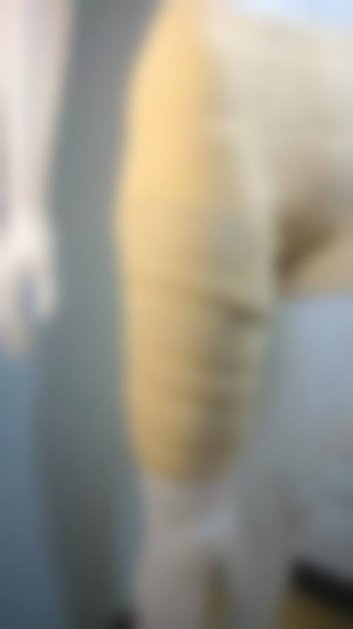 三、阜阳伊尔美整形美容医院诊疗项目有哪些？