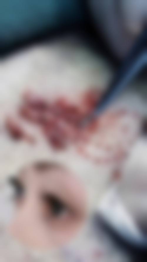 六、姚刚真实的患者评价