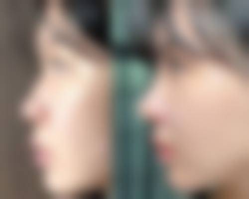 三、姚刚技术优势