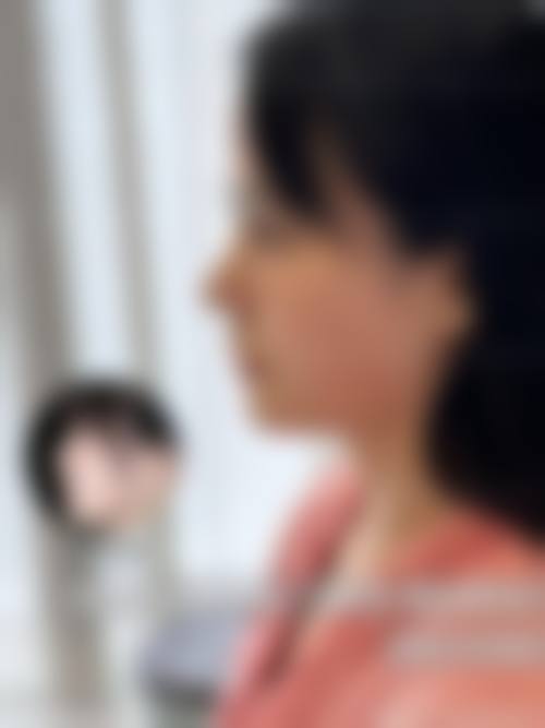 二、合肥新美整形医院怎么样？