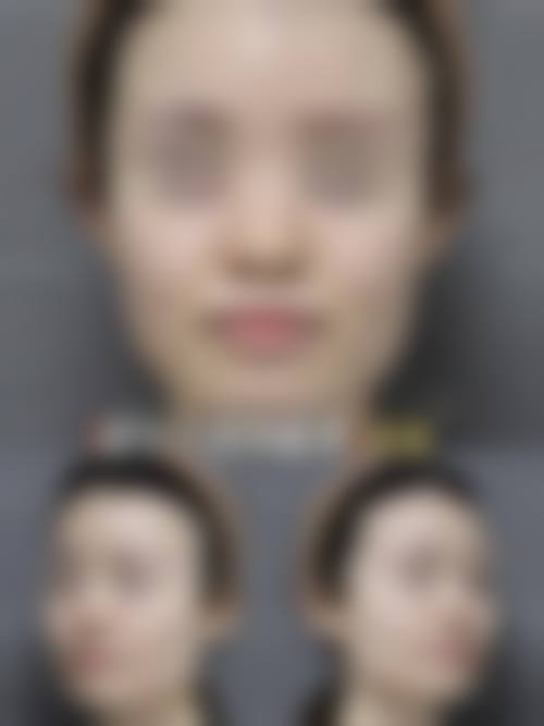 四、福州台江如一整形医院特色项目
