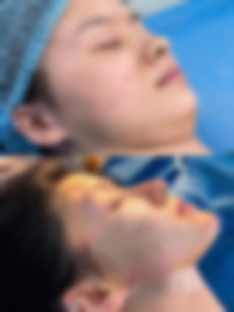 八、福州台江如一整形医院真实的患者评价