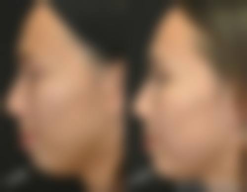 七、昆明悦莱医疗整形美容预约方式