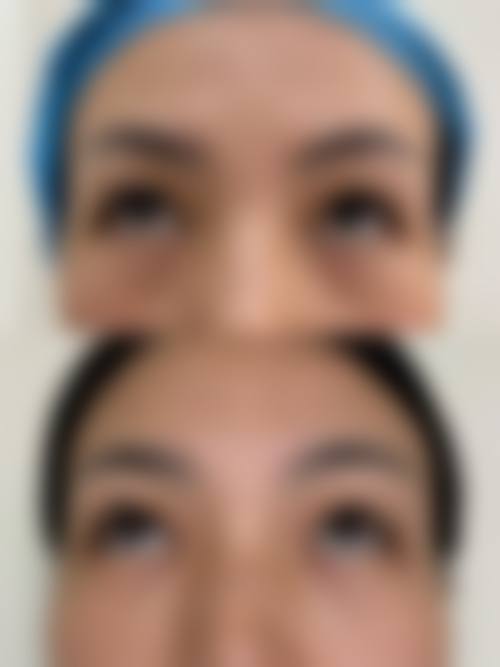 八、成都簇芳笺医疗美容诊所真实的患者评价