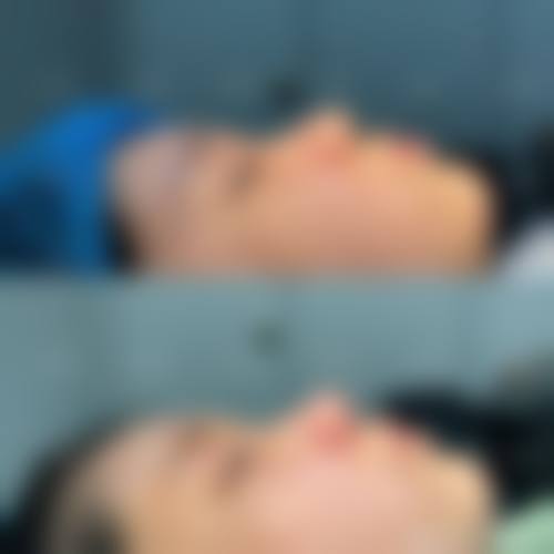 四、杭州港丽医疗美容特色项目