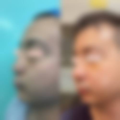 八、杭州港丽医疗美容真实的患者评价