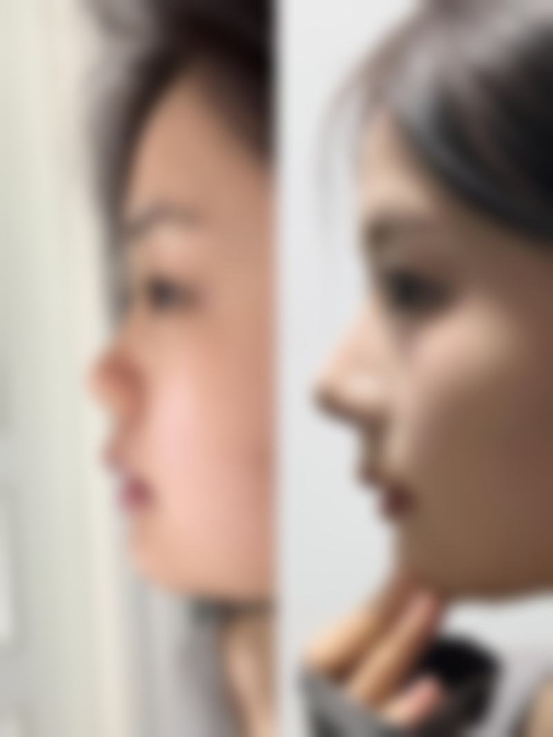二、杭州港丽医疗美容怎么样？
