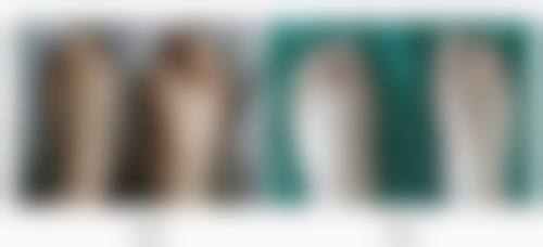 六、双眼皮埋线后出现不适的处理方法