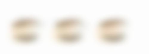 {眼袋做了手术还会长吗？了解这些因素，让你清楚术后眼袋复发可能性