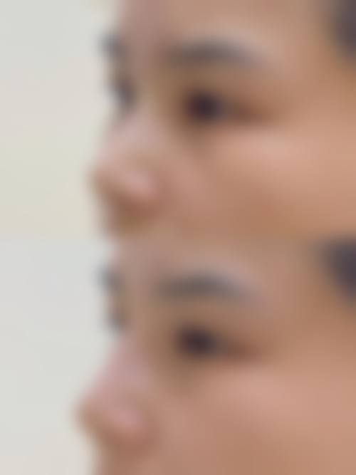 六、乌海鹏爱悦己整形医院价格表