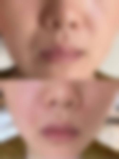 五、大同凤凰妇产医院美容整形医生介绍