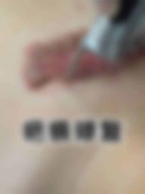 四、乌海鹏爱悦己整形医院特色项目