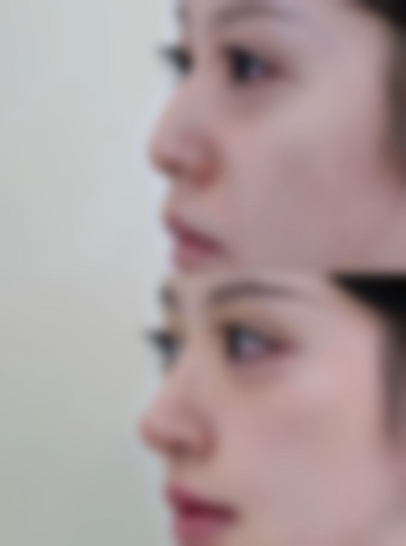 三、大同凤凰妇产医院美容整形诊疗项目有哪些？