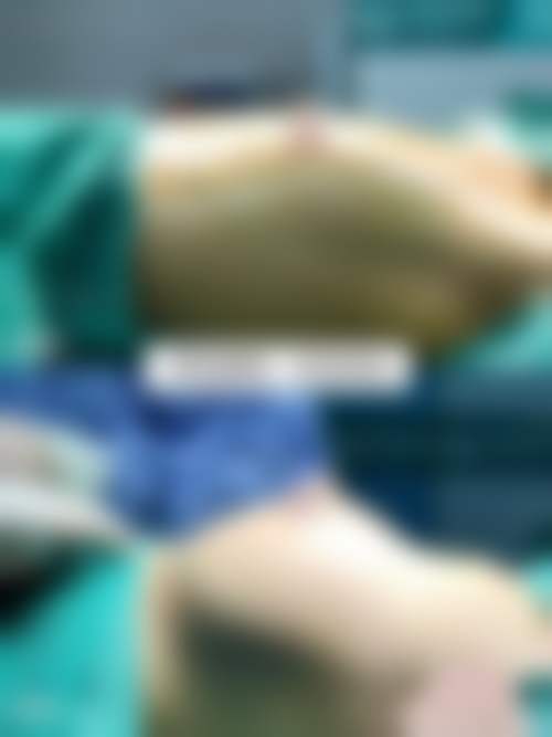 八、昆明医学校整形美容科真实的患者评价