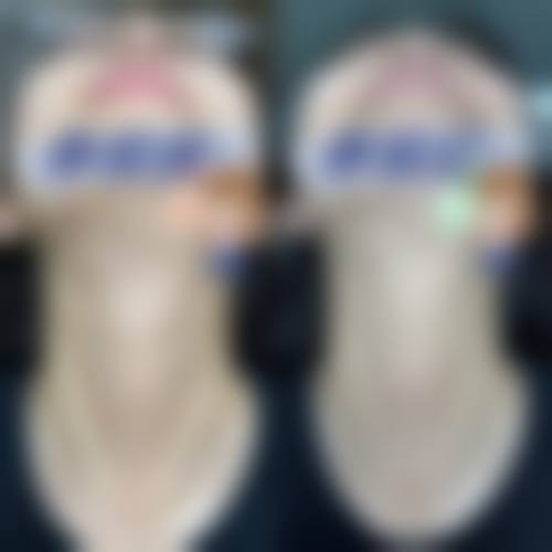 九、佛山超美医疗美容真实的患者评价