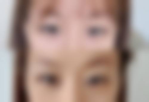 九、齐齐哈尔绣颜挚美整形医疗美容门诊部真实的患者评价