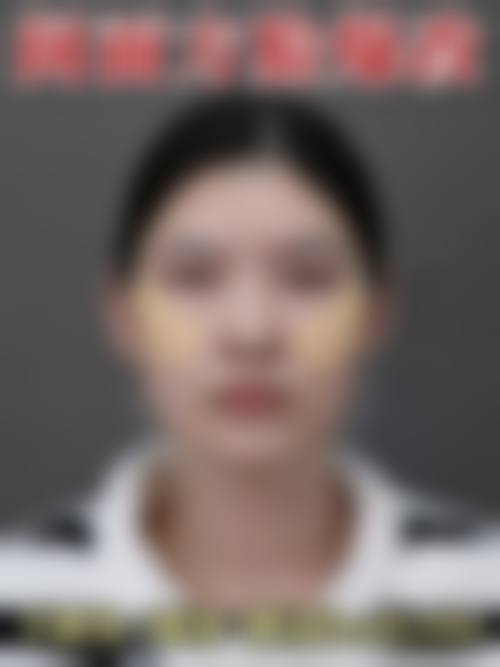 二、韩国巴诺巴奇整形外科医院怎么样？