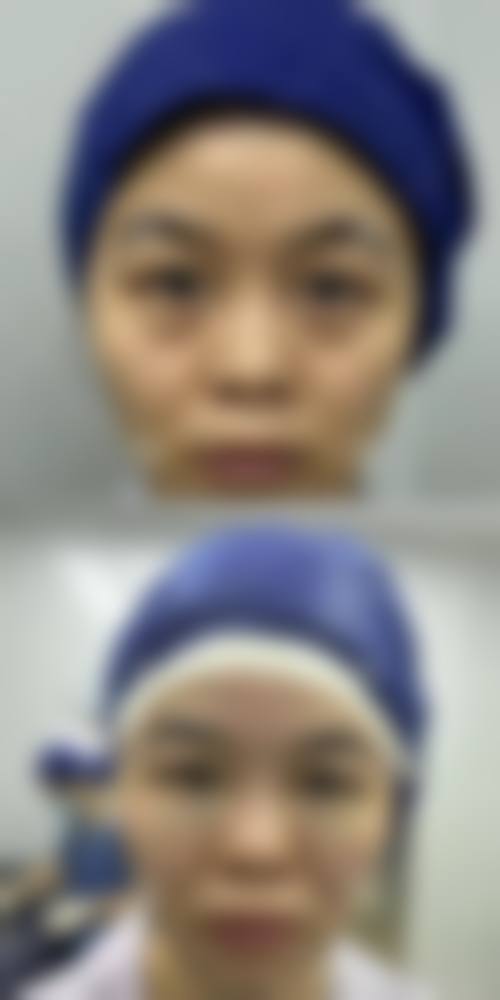 二、海南华美整形医院怎么样?