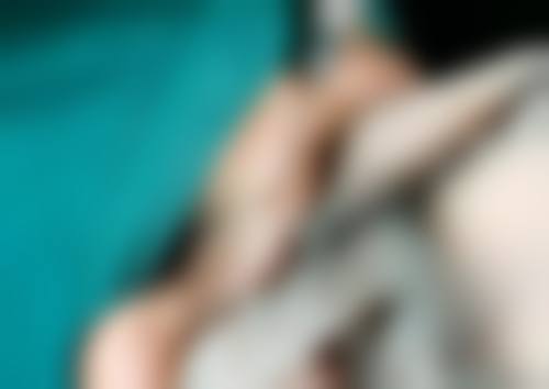 疤痕体质能整双眼皮吗？了解合适术式与护理要点，让你安心变美