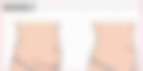 一、一只单眼皮一只双眼皮成因分析