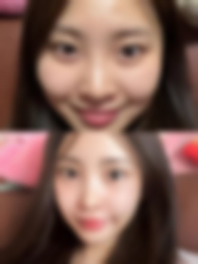 四、手术注意事项