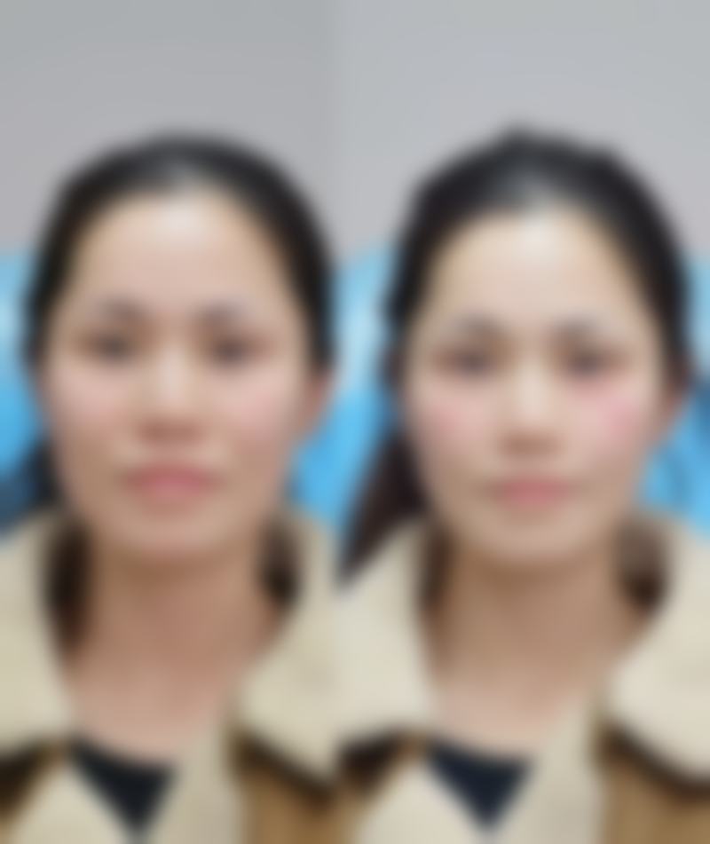 八、长沙香曲曼整形医院真实的患者评价