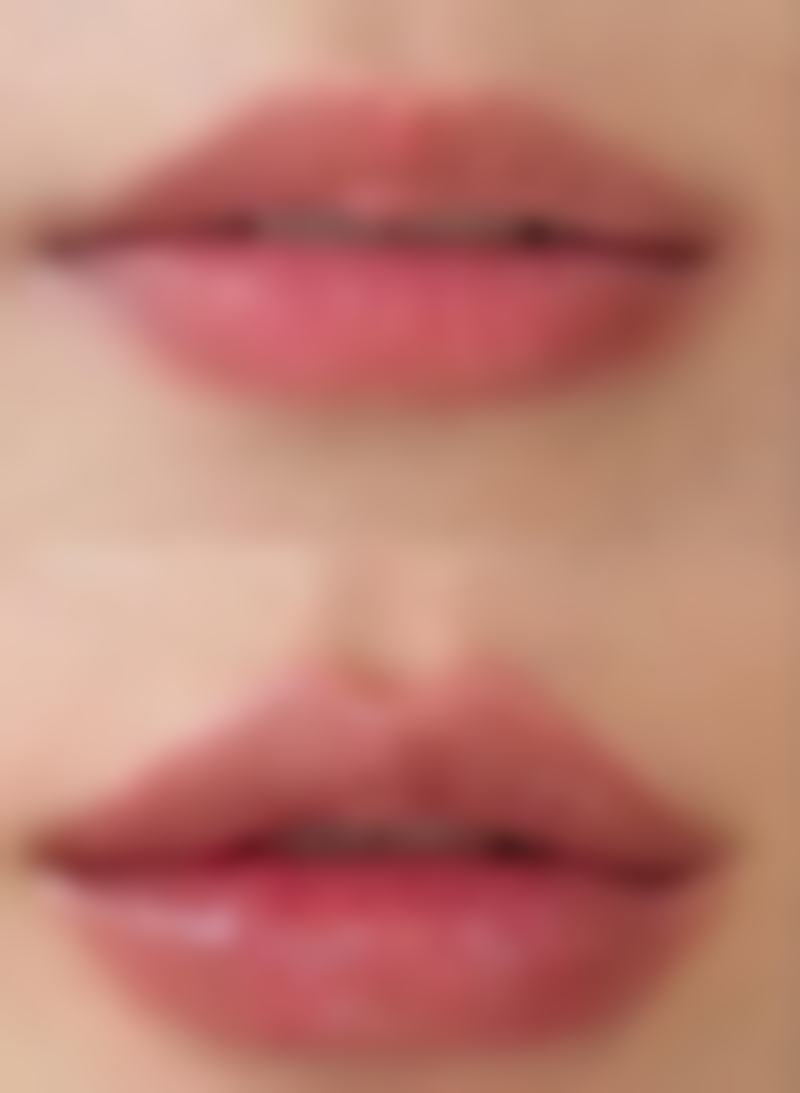 八、疤痕疙瘩包去除前后图片参考