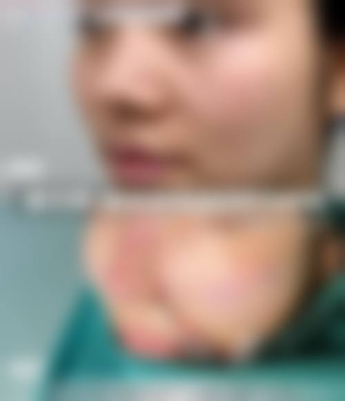五、江阴漾禾整形医院价格表