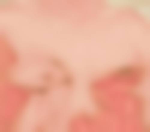 {全切双眼皮淤血多久能消？新陈代谢快慢不同消失时间或7天到10天不等