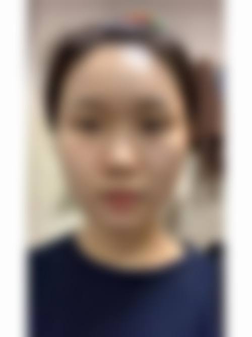 四、西安莲湖瑞丽整形专科医院特色项目