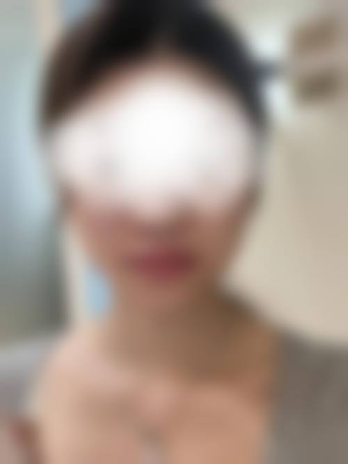 五、西安莲湖瑞丽整形专科医院价格表