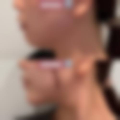 三、李正强技术优势