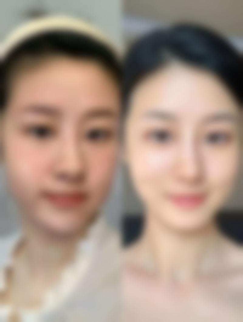 三、吕坚鑫技术优势