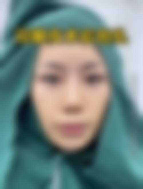 六、于攀真实的患者评价