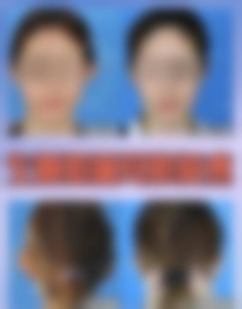 五、东莞和美人整形医院价格表