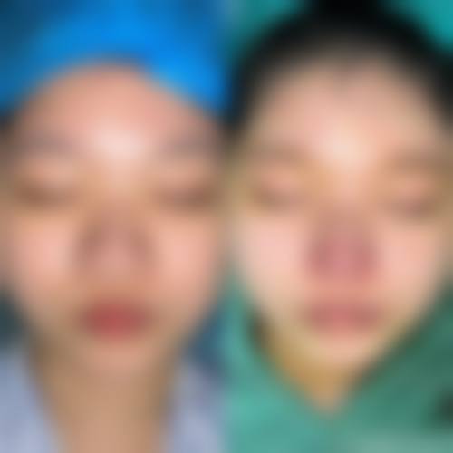 二、濮阳市龙华区张存亮医疗美容怎么样?