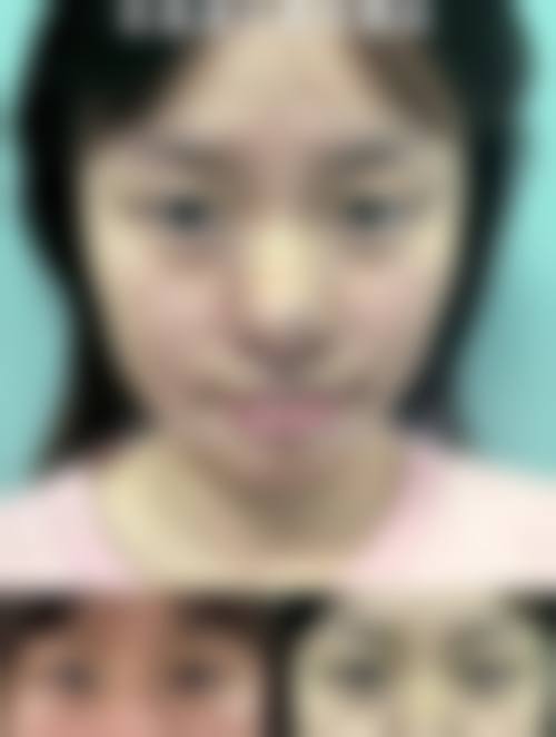 二、哈尔滨泽美医疗美容院怎么样?