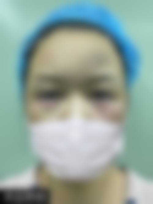 三、哈尔滨泽美医疗美容院诊疗项目有哪些?