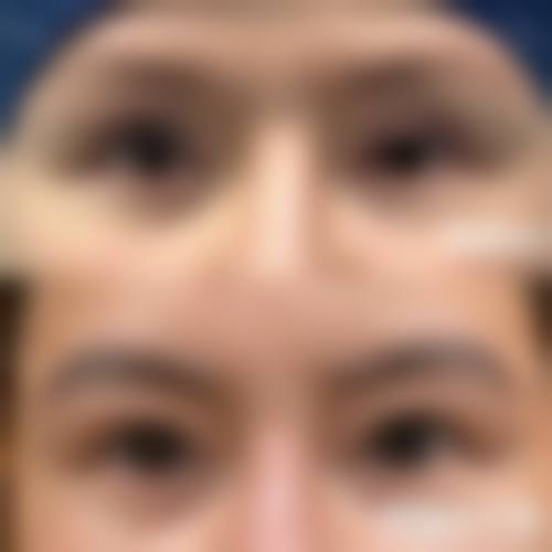 三、湖北荆州华美整形医院诊疗项目有哪些?