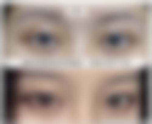 九、湖北荆州华美整形医院真实的患者评价