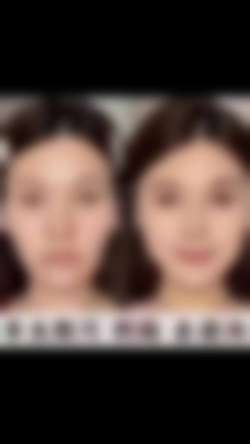 八、深圳积美整形医学美容门诊部真实的患者评价