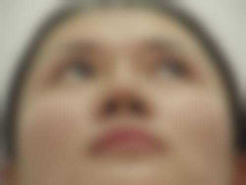 四、深圳积美整形医学美容门诊部特色项目
