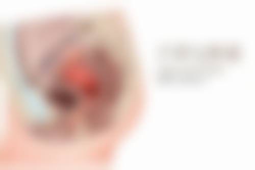 三、延长玻尿酸隆胸维持时长的妙招
