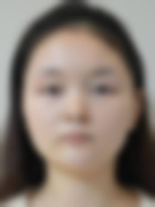 九、贵州利美康整形外科医院真实的患者评价
