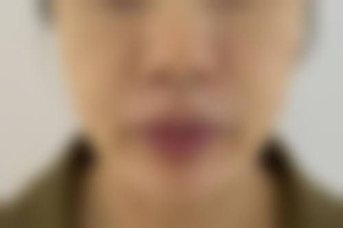 三、韩国Orbit皮肤科医院诊疗项目有哪些?