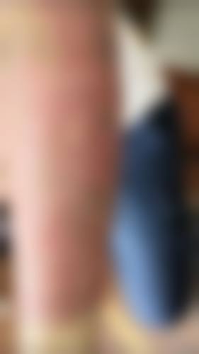 六、赵晓兰真实的患者评价